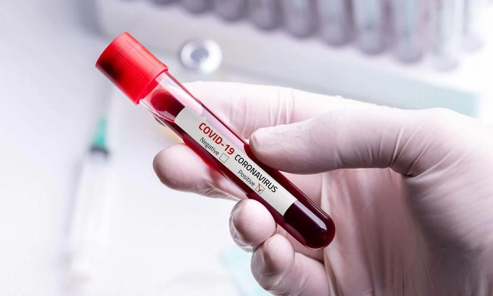 Coronavirus: Ποια ομάδα αίματος έχει τον υψηλότερο κίνδυνο να προσβληθεί